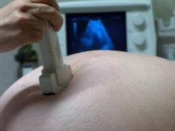 Perdite ematiche cicliche in gravidanza | Noi Mamme