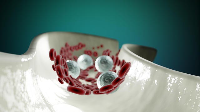 Malformazione arteria ombelicale