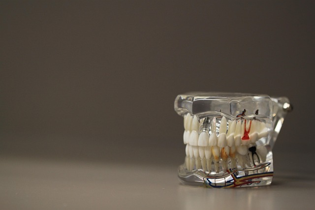 Denti permanenti gialli