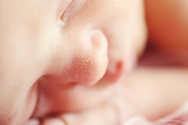 Macchie rosse e coliche: intolleranza al latte?