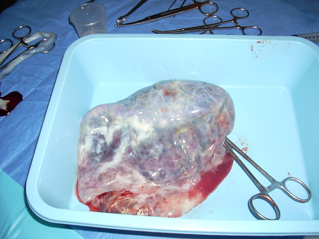 Cordone attorcigliato e crescita ridotta
