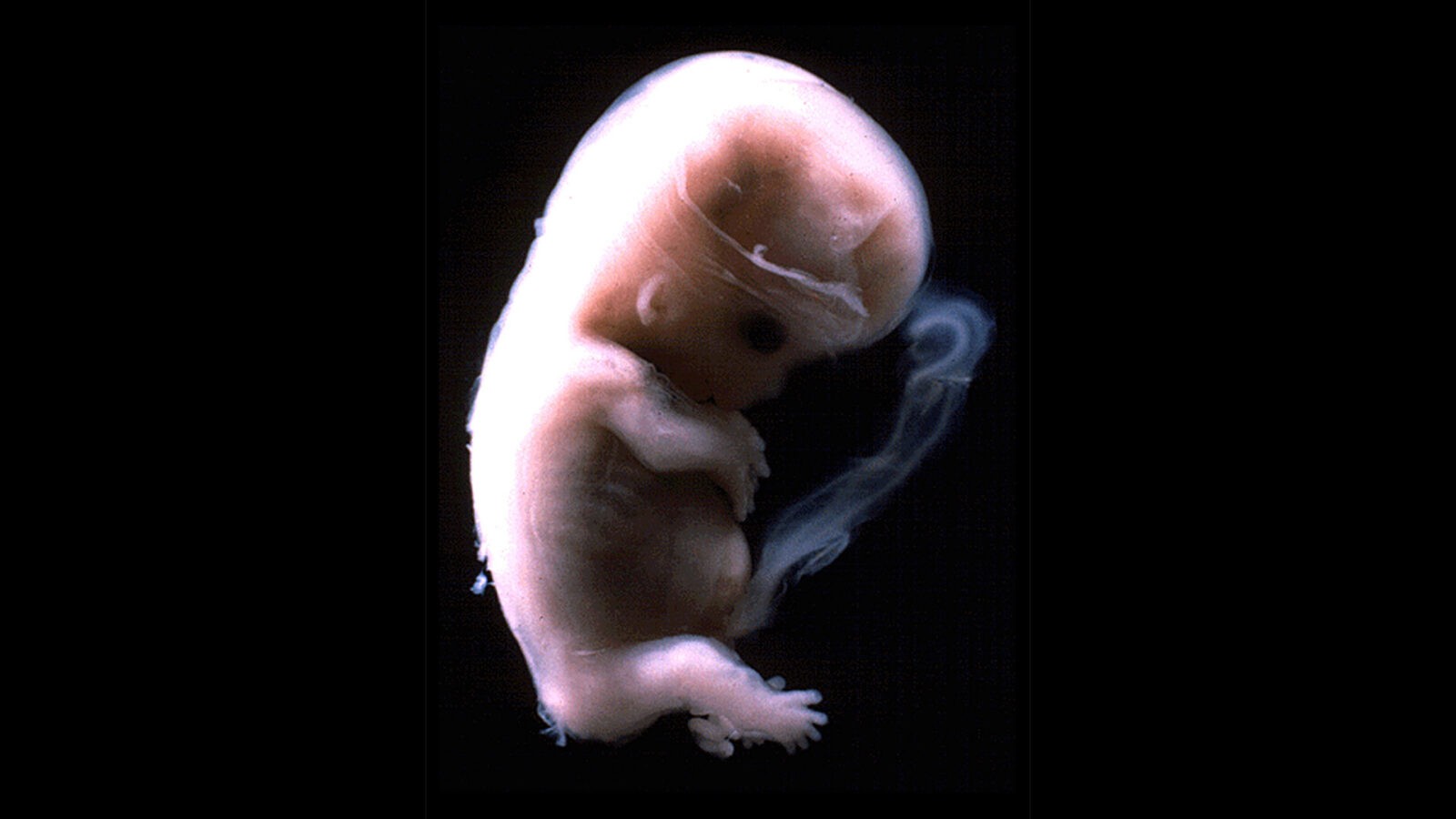 Gravidanza: la trasformazione da embrione a feto, mese per mese | Noi Mamme 1