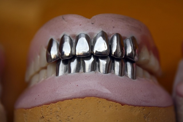 Dente cresciuto verso il palato