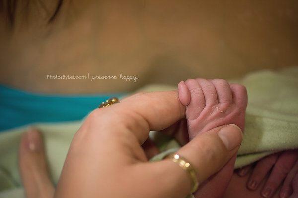 Il bambino con 6 dita - Foto di Leilani Rogers 
