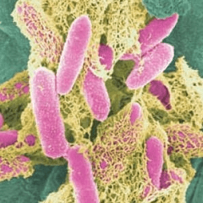 Cos'è la Meningite da Escherichia Coli? | Noi Mamme