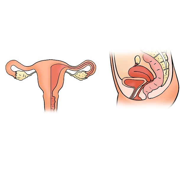 Endometriosi: che cos'è e come si cura | Noi Mamme 1