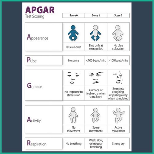 indice apgar
