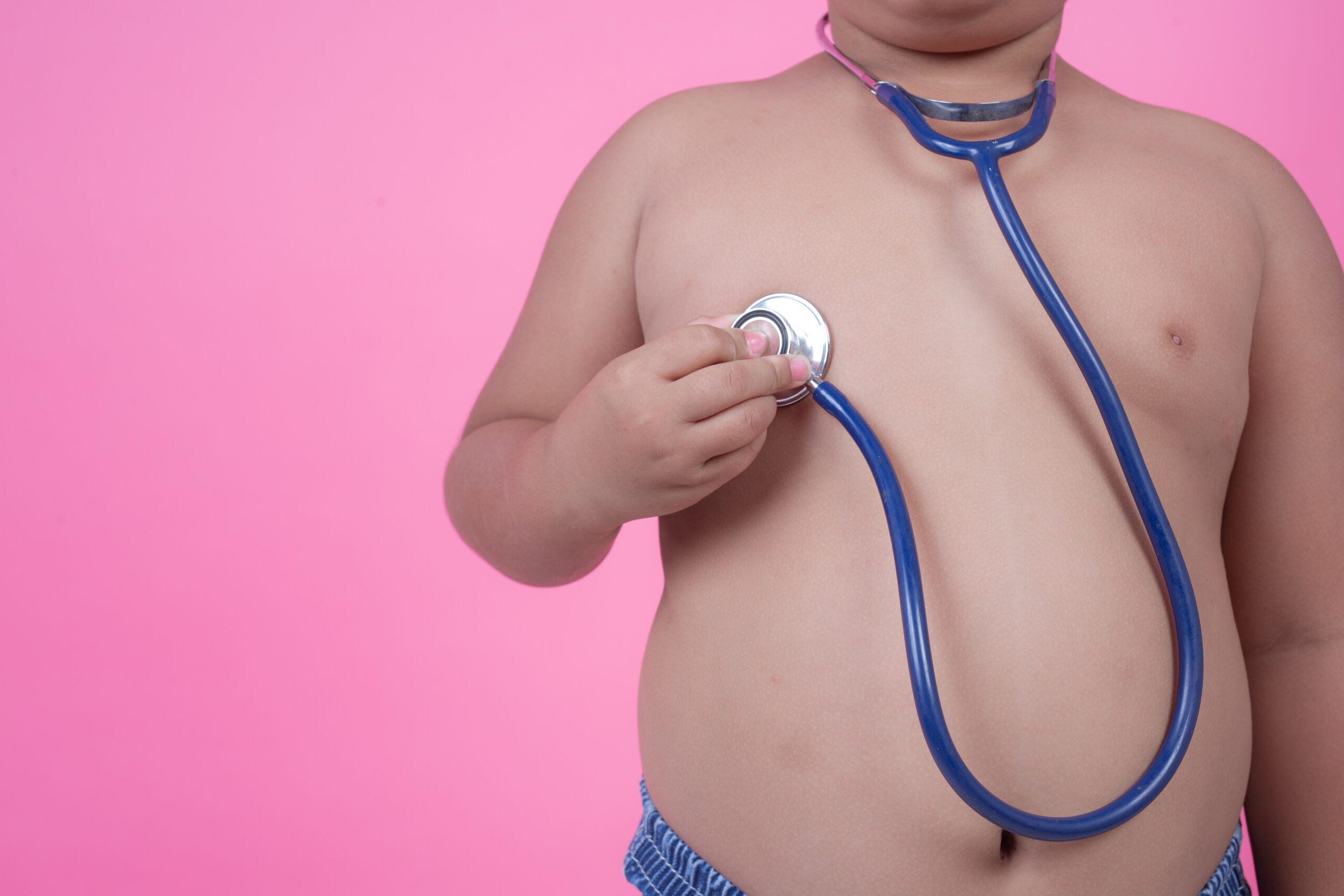 Obesità infantile e conseguenze sulla salute