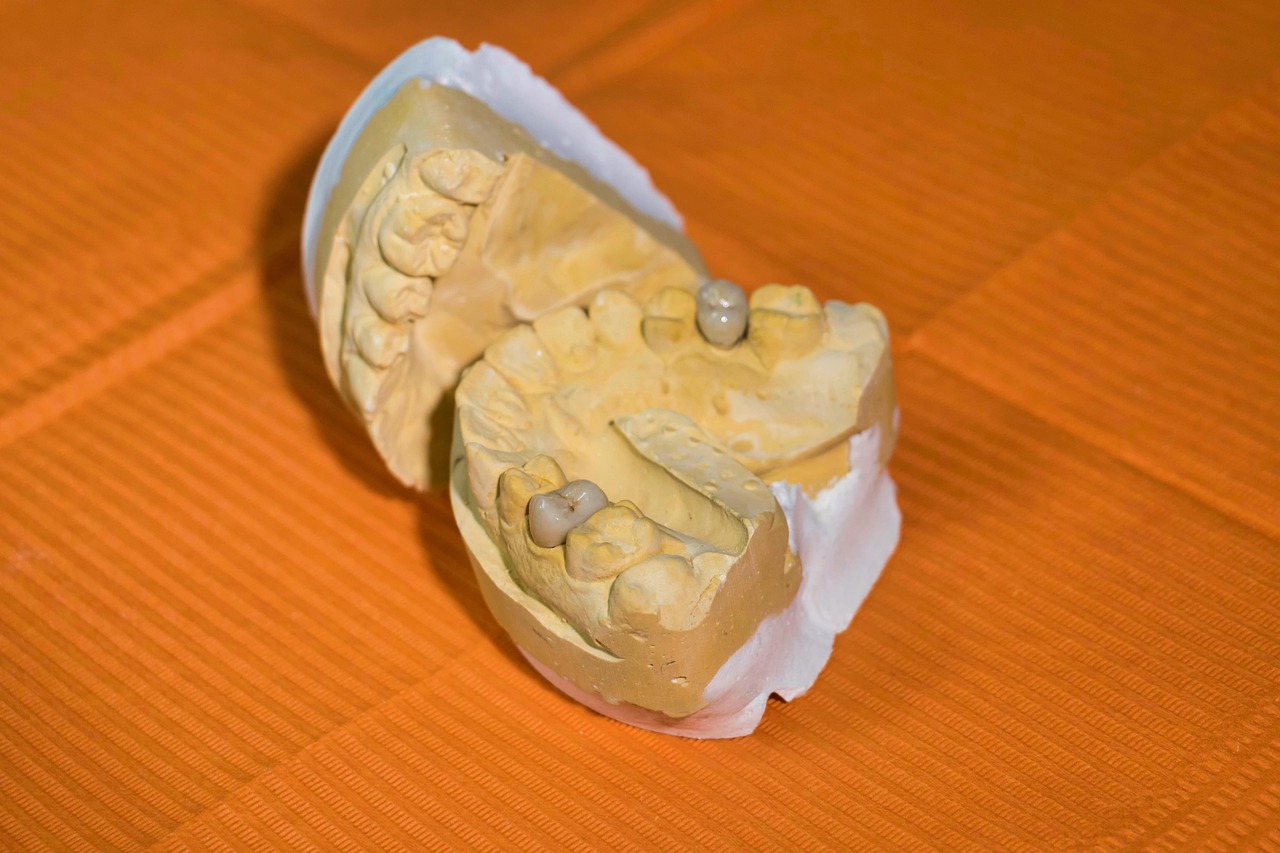 Dentini Gialli nei Bambini: Cause, Prevenzione e Rimedi Efficaci